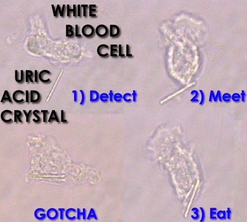 Uric Acid Crystal