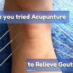 Does Gout Pain and Acupuncture work for you?