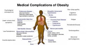 Disease Complications in Gout